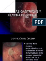 Ulcera Gastrica y Duodenal