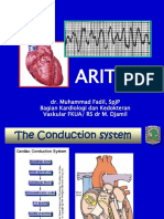 Aritmia: Dr. Muhammad Fadil, SPJP Bagian Kardiologi Dan Kedokteran Vaskular Fkua/ Rs DR M. Djamil
