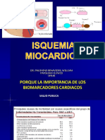 Isquemia Miocardica