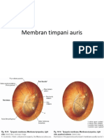 Membran Timpani Aurisisisi