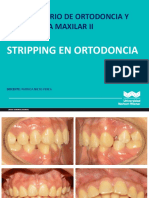 Stripping en Ortodoncia