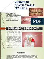 Enfermedad Periodontal