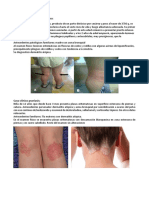 Caso Clínico de Dermatitis Atópica