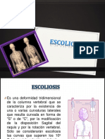 Escoliosis Exposicion