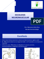 Escoliosis Neuromuscular