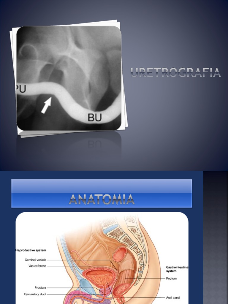 Uretrografia EE