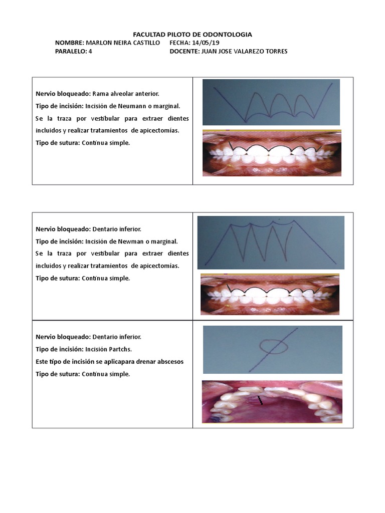 Incisiones y Suturas en Odontología | PDF | Odontología | Ramas de ...