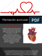 Fibrilación auricular.pptx