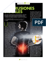 Protusiones Discales