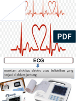 Ecg