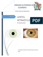 lentes intraoculares