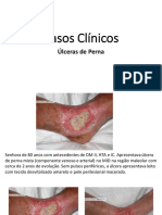 AULA 15 – Casos Clínicos Úlceras de Perna