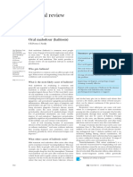 Clinical Review: Oral Malodour (Halitosis)