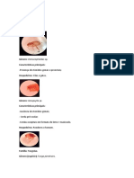 Pulgas, piolhos, moscas e outros ectoparasitas