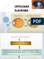 Penyuluhan Glaukoma.ppt