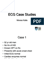 ECG Case Studies Moosa1.