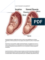 Placenta WPS Office