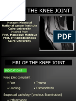 Mri of Knee Joint Hossam Massoud