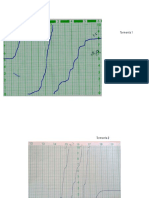 Graficas Pluviogramas