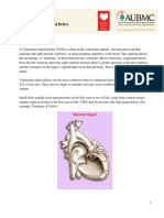 Ventricular Septal Defect