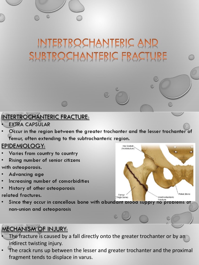 Inter and Sub Trochanteric Fracture | PDF | Hip | Skeletal System