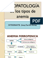 Tipos de Anemia