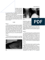 Cases Patient 1: FIG. 2. The X-Ray Depicting Neck Facet Degenerative Changes of Patient 1