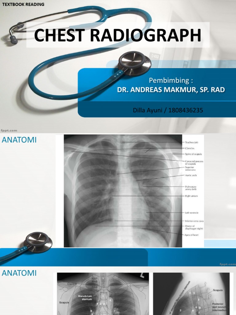 Radiologi | PDF