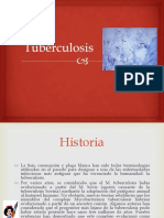 Tuberculosis