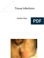 Soft Tissue Infections: Ardian Riza