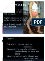 Poliomyelitis