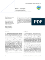 Burning Mouth Syndrome: A Case Report