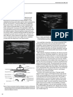 Correspondence: A New Ultrasound-Guided Dorsal Penile Nerve Block Technique For Circumcision in Children