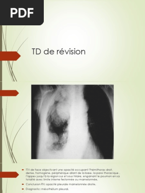 Td De Revision 1 Pptx Thorax Poumon