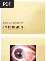 Download PTERIGIUM by Lita Yanuarti SN43508400 doc pdf