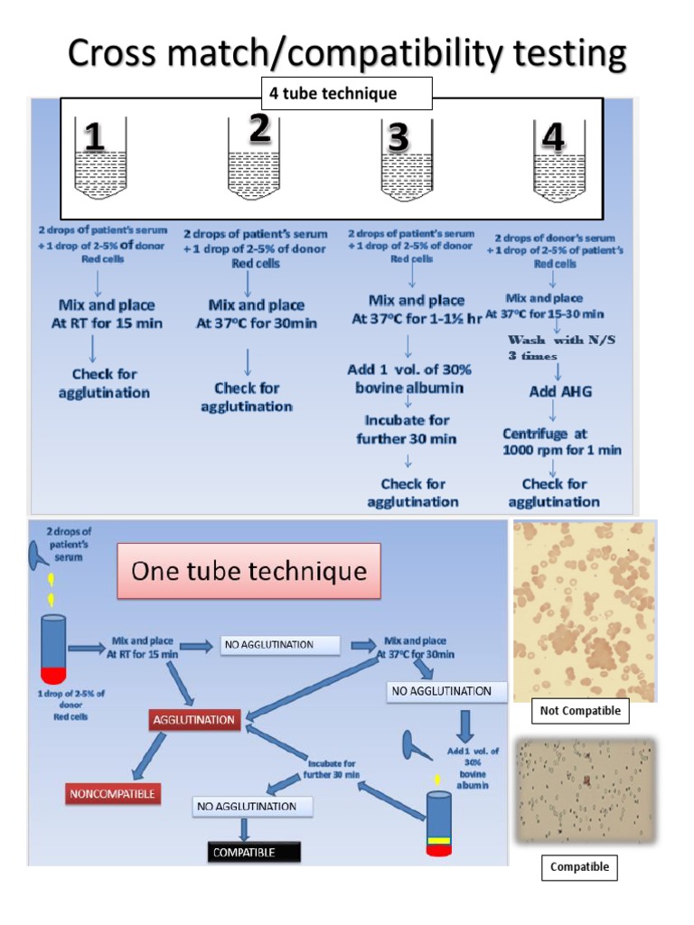 Cross Testing 4 Tube Technique PDF