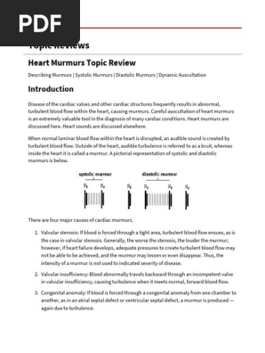 Heart Murmurs Topic Review - From Description to Auscultation