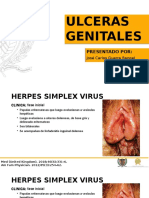 Ulceras Genitales
