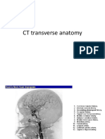 07 CT Transverse Anatomy
