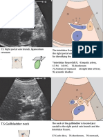 Ultrasound Landmarks and Anatomy of the Biliary System