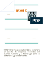 Rayos X del tórax: anatomía radiológica normal y patología pulmonar más común