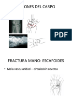 09, Lesiones Del Carpo