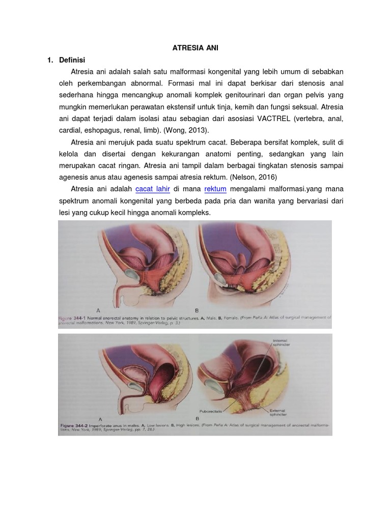 Atresia Ani: Definisi dan Klasifikasi | PDF