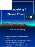 Recognizing A Pleural Effusion
