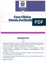 Fistula Perilinfatica