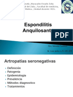 Espondilitis Anquilosante