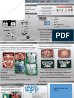 Process of Rapifd Prototyping