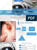 Episkleritis & Skleritis