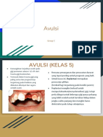 Trauma Gigi Pada Anak Kelas V (Avulsi)