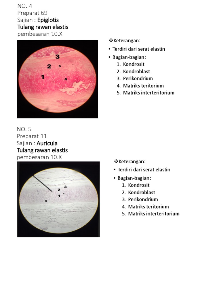 Keterangan Terdiri Dari Serat Elastin Bagian Bagian 1 Kondrosit 2 Kondroblast 3 Perikondrium 4 Matriks Teritorium 5 Matriks Interteritorium
